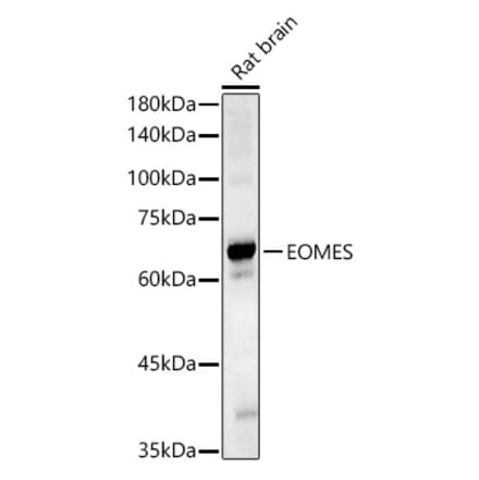 Western Blot - Anti-TBR2 / Eomes Antibody (A308331) - Antibodies.com