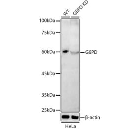 Western Blot - Anti-Glucose 6 Phosphate Dehydrogenase Antibody (A308333) - Antibodies.com