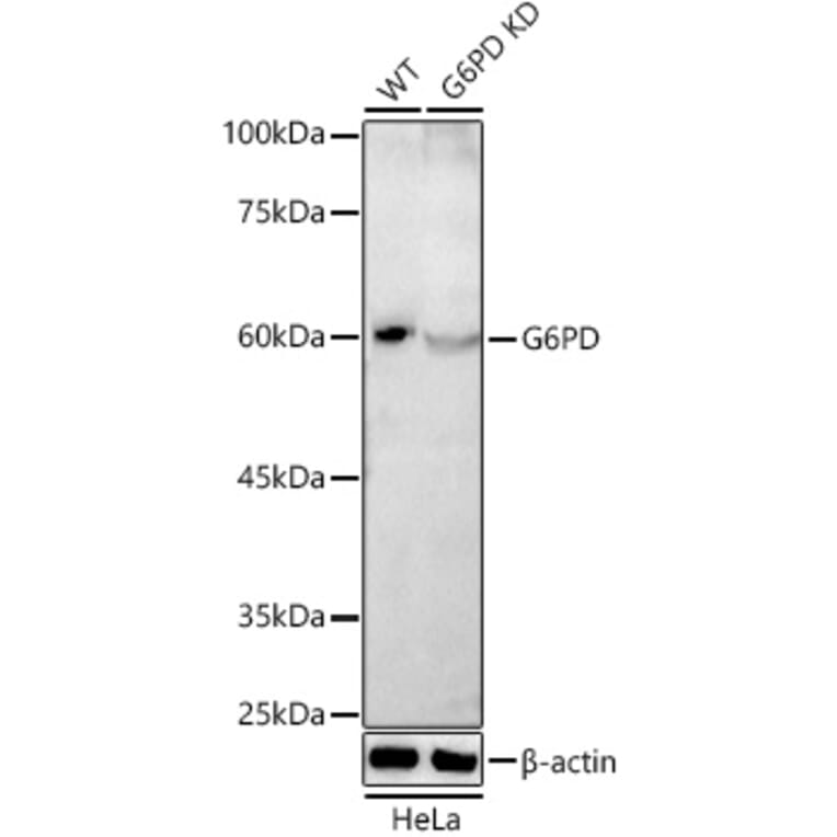 Western Blot - Anti-Glucose 6 Phosphate Dehydrogenase Antibody (A308333) - Antibodies.com