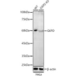 Western Blot - Anti-Glucose 6 Phosphate Dehydrogenase Antibody (A308333) - Antibodies.com