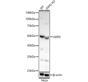 Western Blot - Anti-Glucose 6 Phosphate Dehydrogenase Antibody (A308334) - Antibodies.com