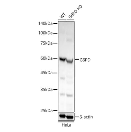 Western Blot - Anti-Glucose 6 Phosphate Dehydrogenase Antibody (A308334) - Antibodies.com