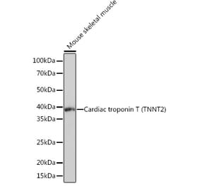 Western Blot - Anti-Cardiac Troponin T Antibody [ARC1242] (A308336) - Antibodies.com