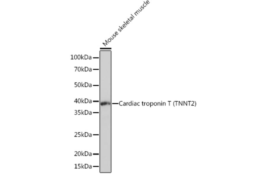 Western Blot - Anti-Cardiac Troponin T Antibody [ARC1242] (A308336) - Antibodies.com