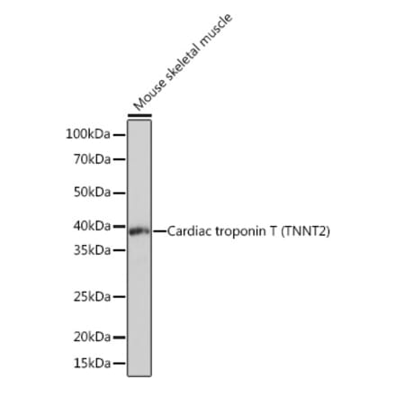 Western Blot - Anti-Cardiac Troponin T Antibody [ARC1242] (A308336) - Antibodies.com