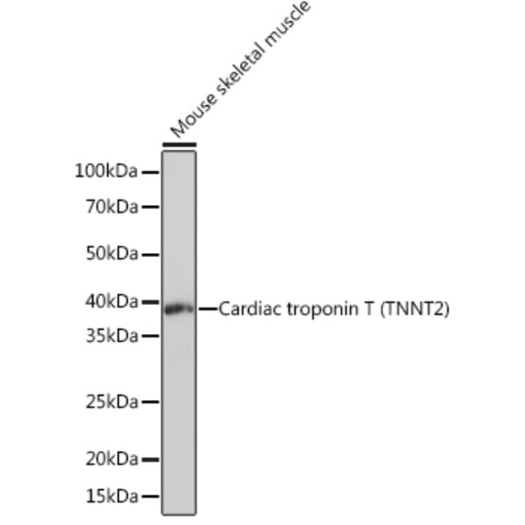 Western Blot - Anti-Cardiac Troponin T Antibody [ARC1242] (A308336) - Antibodies.com