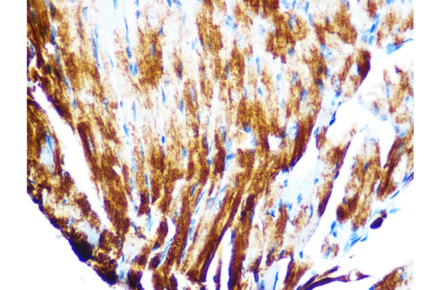 Immunohistochemistry - Anti-Cardiac Troponin T Antibody [ARC1242] (A308336) - Antibodies.com