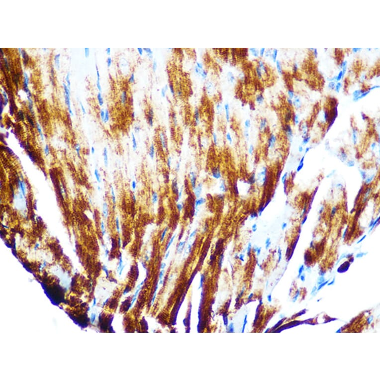 Immunohistochemistry - Anti-Cardiac Troponin T Antibody [ARC1242] (A308336) - Antibodies.com