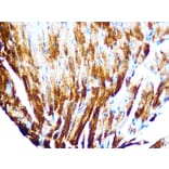 Immunohistochemistry - Anti-Cardiac Troponin T Antibody [ARC1242] (A308336) - Antibodies.com