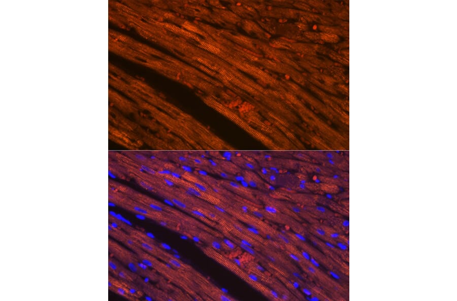Immunofluorescence - Anti-Cardiac Troponin T Antibody [ARC1242] (A308336) - Antibodies.com