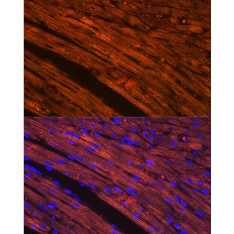 Immunofluorescence - Anti-Cardiac Troponin T Antibody [ARC1242] (A308336) - Antibodies.com