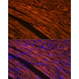 Immunofluorescence - Anti-Cardiac Troponin T Antibody [ARC1242] (A308336) - Antibodies.com