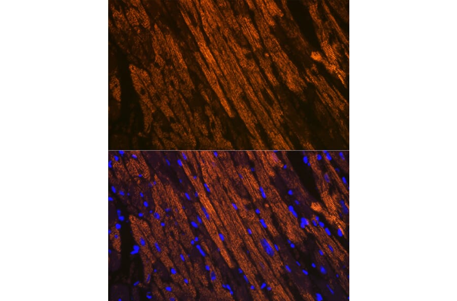Immunofluorescence - Anti-Cardiac Troponin T Antibody [ARC1242] (A308336) - Antibodies.com