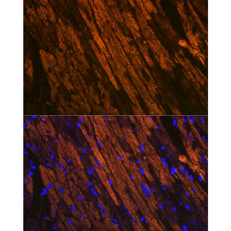 Immunofluorescence - Anti-Cardiac Troponin T Antibody [ARC1242] (A308336) - Antibodies.com