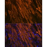 Immunofluorescence - Anti-Cardiac Troponin T Antibody [ARC1242] (A308336) - Antibodies.com