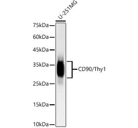 Western Blot - Anti-CD90 / Thy1 Antibody [ARC55647] (A308337) - Antibodies.com