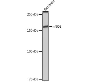 Western Blot - Anti-nNOS (neuronal) Antibody [ARC2611] (A308339) - Antibodies.com