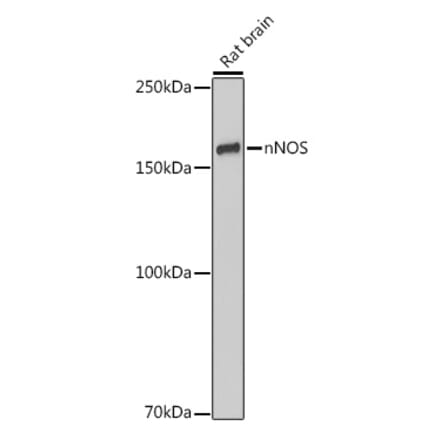 Western Blot - Anti-nNOS (neuronal) Antibody [ARC2611] (A308339) - Antibodies.com