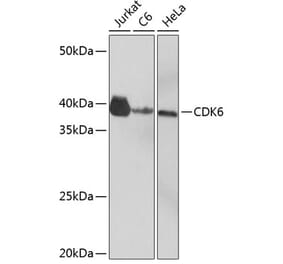 Western Blot - Anti-Cdk6 Antibody [ARC0224] (A308341) - Antibodies.com