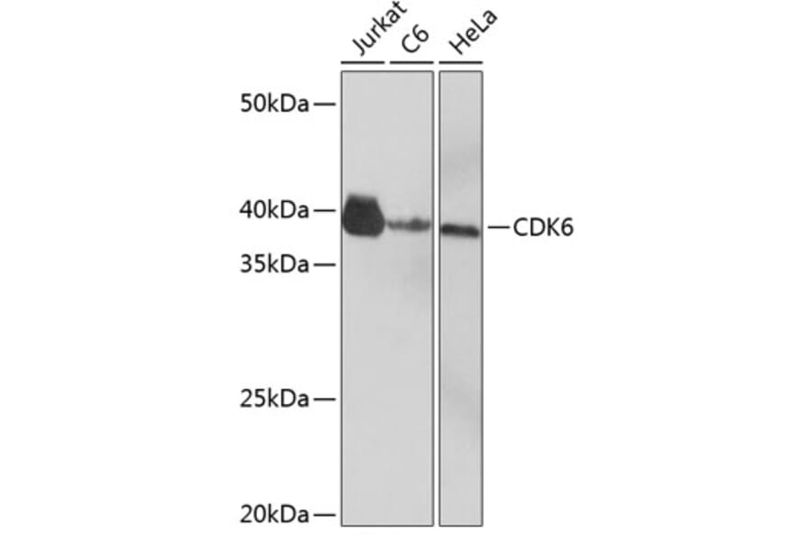 Western Blot - Anti-Cdk6 Antibody [ARC0224] (A308341) - Antibodies.com