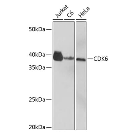 Western Blot - Anti-Cdk6 Antibody [ARC0224] (A308341) - Antibodies.com
