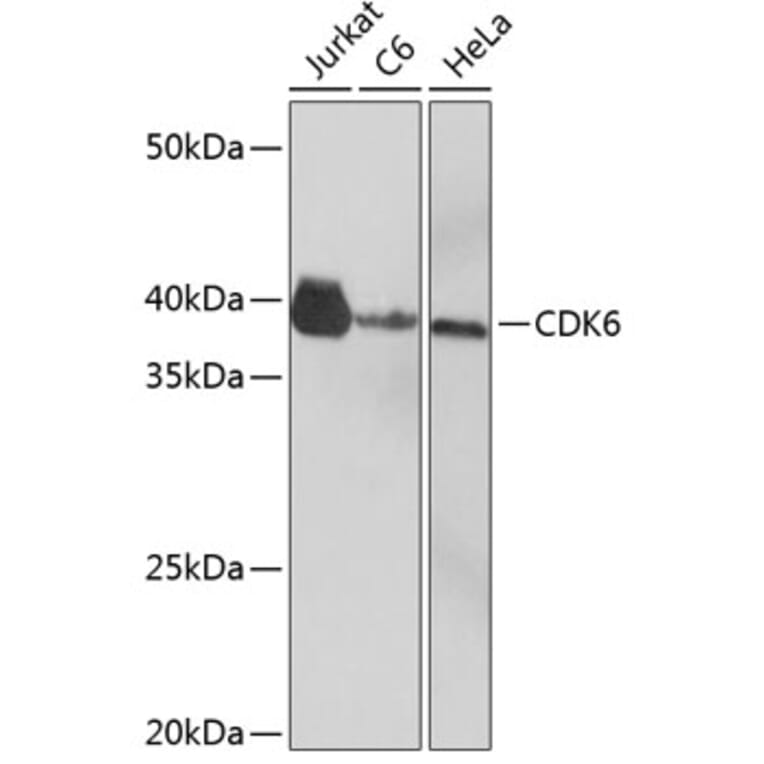 Western Blot - Anti-Cdk6 Antibody [ARC0224] (A308341) - Antibodies.com