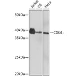 Western Blot - Anti-Cdk6 Antibody [ARC0224] (A308341) - Antibodies.com