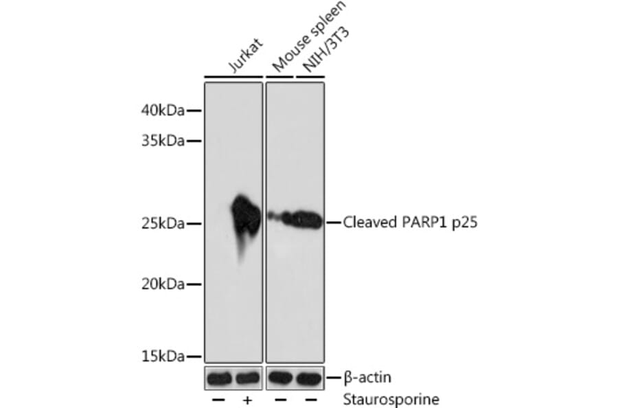 Western Blot - Anti-Cleaved PARP1 Antibody [ARC0091] (A308342) - Antibodies.com
