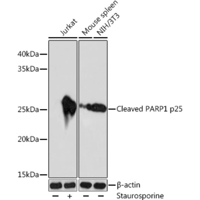 Western Blot - Anti-Cleaved PARP1 Antibody [ARC0091] (A308342) - Antibodies.com