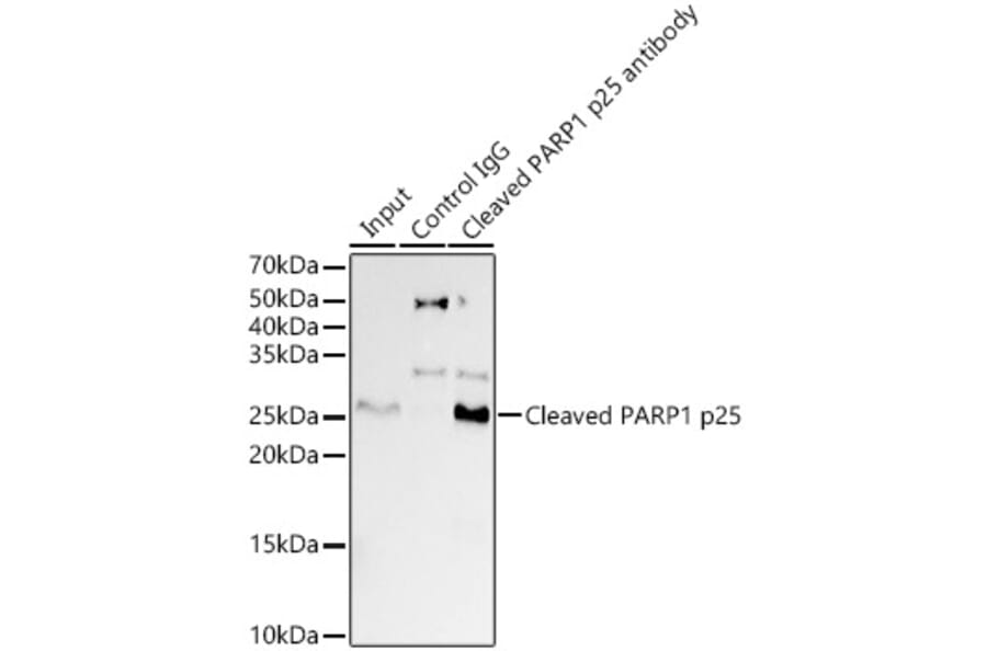 Western Blot - Anti-Cleaved PARP1 Antibody [ARC0091] (A308342) - Antibodies.com