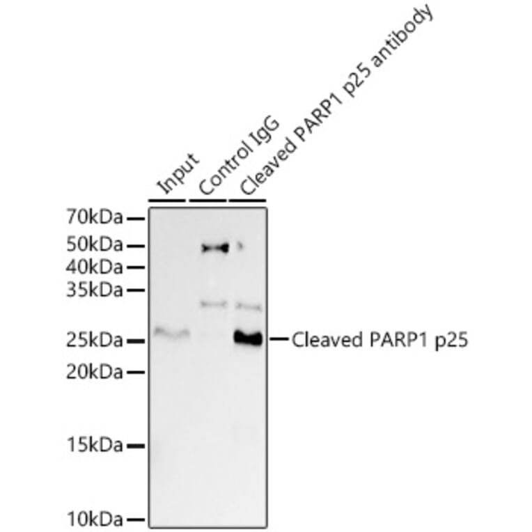 Western Blot - Anti-Cleaved PARP1 Antibody [ARC0091] (A308342) - Antibodies.com