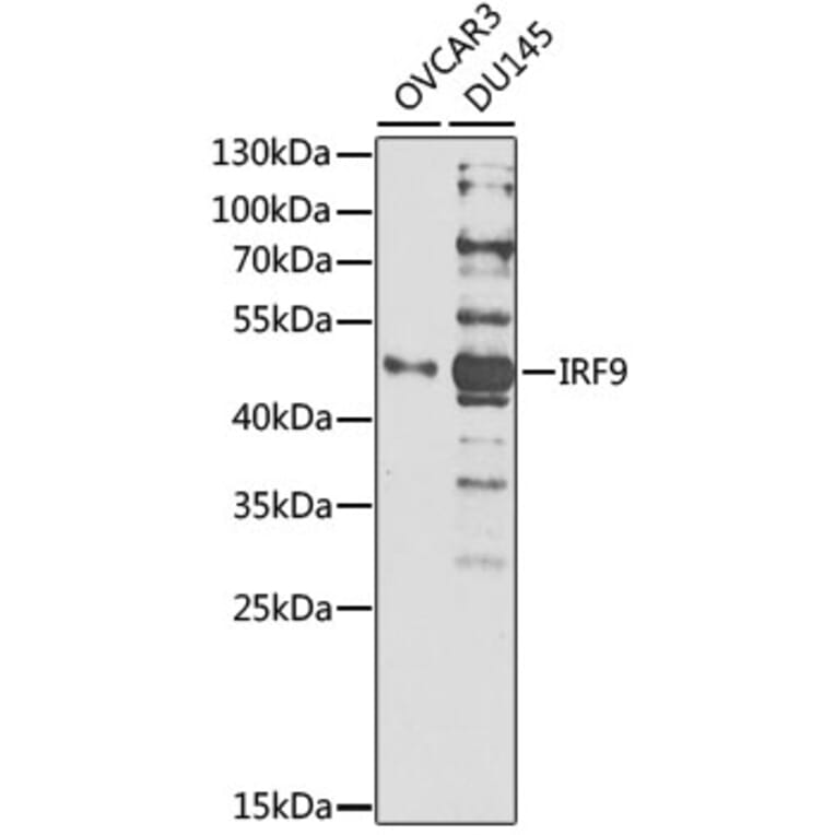 Western Blot - Anti-Interferon regulatory factor 9/IRF-9 Antibody (A308343) - Antibodies.com