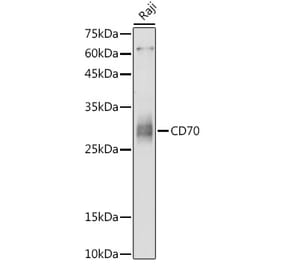 Western Blot - Anti-CD70 Antibody (A308344) - Antibodies.com