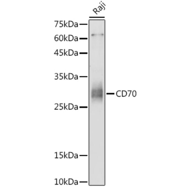 Western Blot - Anti-CD70 Antibody (A308344) - Antibodies.com