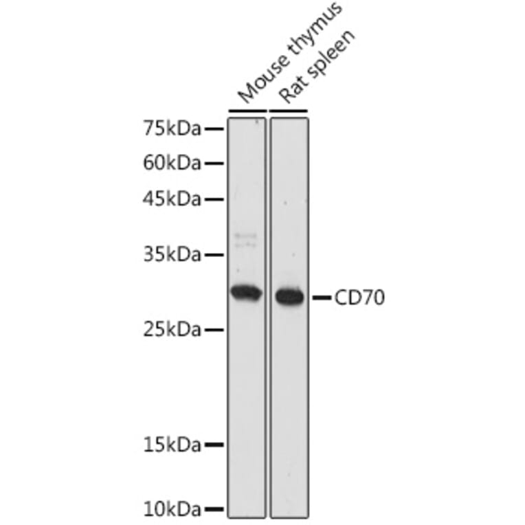 Western Blot - Anti-CD70 Antibody (A308344) - Antibodies.com