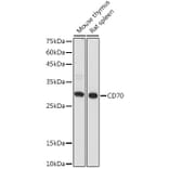 Western Blot - Anti-CD70 Antibody (A308344) - Antibodies.com