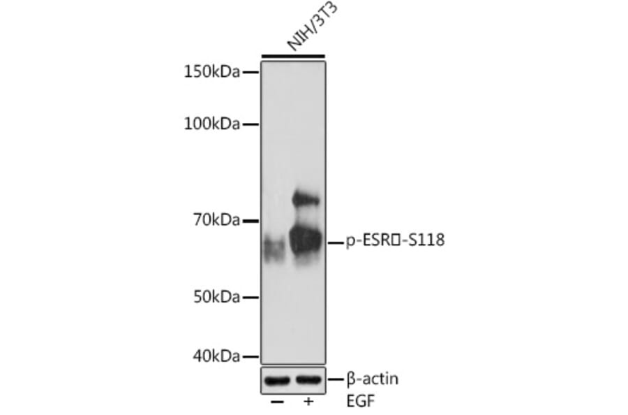 Western Blot - Anti-Estrogen Receptor alpha (phospho Ser118) Antibody [ARC1549] (A308346) - Antibodies.com
