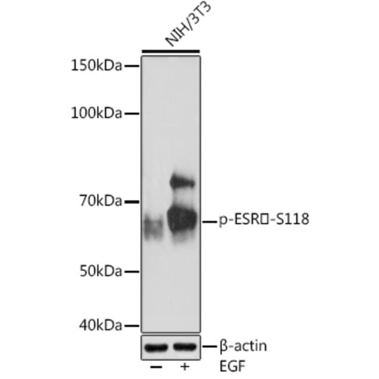 Western Blot - Anti-Estrogen Receptor alpha (phospho Ser118) Antibody [ARC1549] (A308346) - Antibodies.com