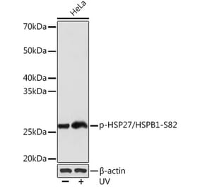 Western Blot - Anti-Hsp27 (phospho Ser82) Antibody (A308347) - Antibodies.com