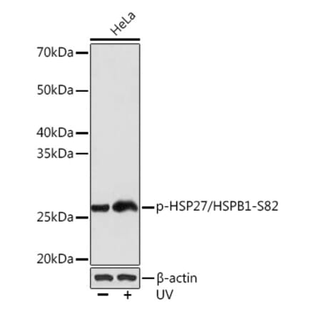 Western Blot - Anti-Hsp27 (phospho Ser82) Antibody [ARC1576] (A308347) - Antibodies.com