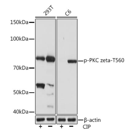 Western Blot - Anti-PKC zeta (phospho Thr560) Antibody [ARC1617] (A308348) - Antibodies.com
