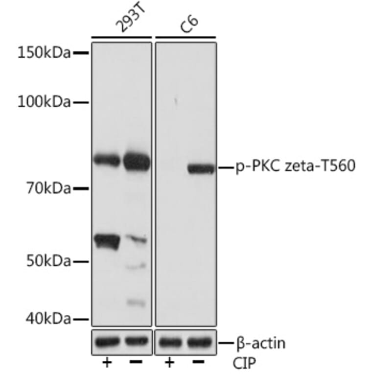 Western Blot - Anti-PKC zeta (phospho Thr560) Antibody [ARC1617] (A308348) - Antibodies.com