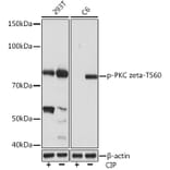 Western Blot - Anti-PKC zeta (phospho Thr560) Antibody [ARC1617] (A308348) - Antibodies.com