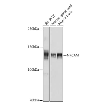 Western Blot - Anti-NrCAM Antibody (A308349) - Antibodies.com