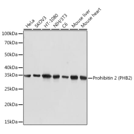 Western Blot - Anti-REA Antibody [ARC1449] (A308350) - Antibodies.com
