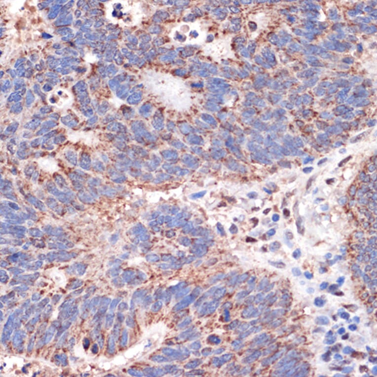 Immunohistochemistry - Anti-REA Antibody [ARC1449] (A308350) - Antibodies.com