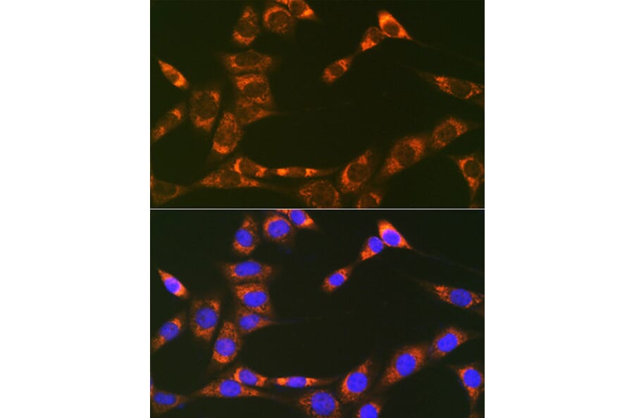 Immunofluorescence - Anti-REA Antibody [ARC1449] (A308350) - Antibodies.com