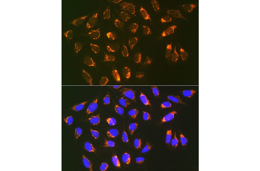 Immunofluorescence - Anti-REA Antibody [ARC1449] (A308350) - Antibodies.com