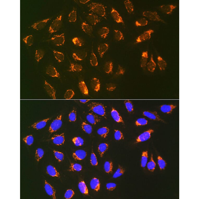 Immunofluorescence - Anti-REA Antibody [ARC1449] (A308350) - Antibodies.com