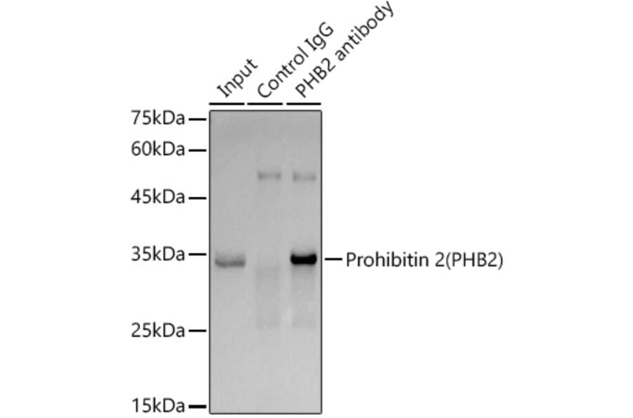 Western Blot - Anti-REA Antibody [ARC1449] (A308350) - Antibodies.com